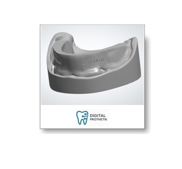 Aesthtische Bissschablonen ExoCad