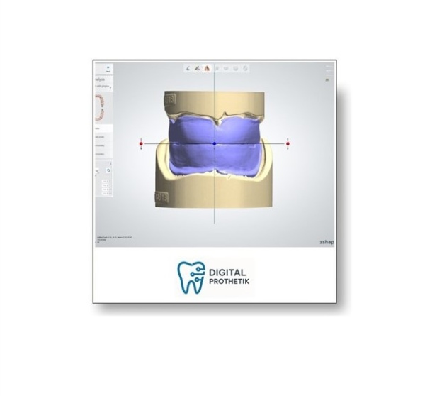 Digitale Modellanalyse 