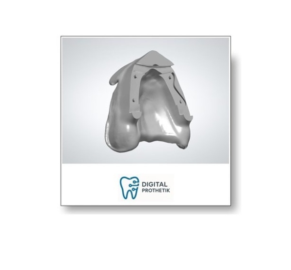 Stützstift Registrierung nach Prof.A.Gerber