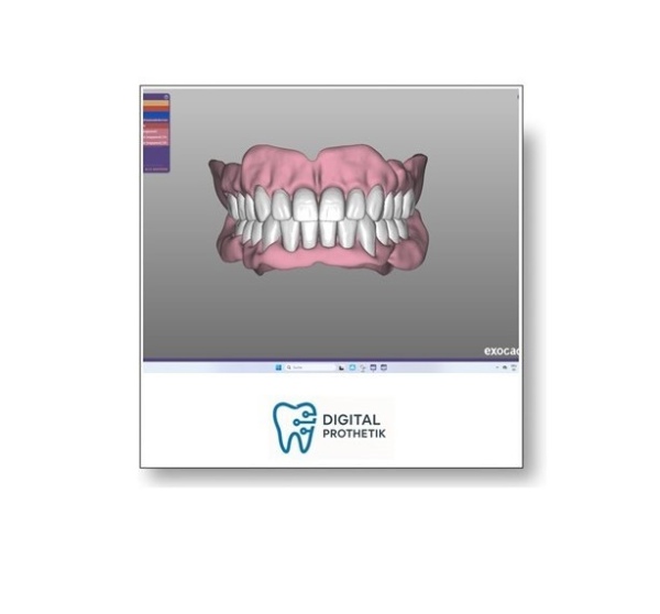Exocad Grundkurs Level 1